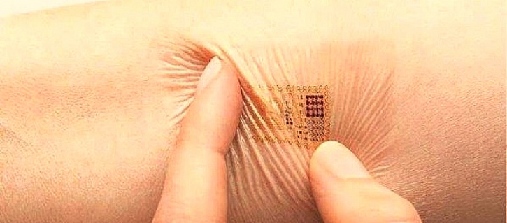 skin tag microchip